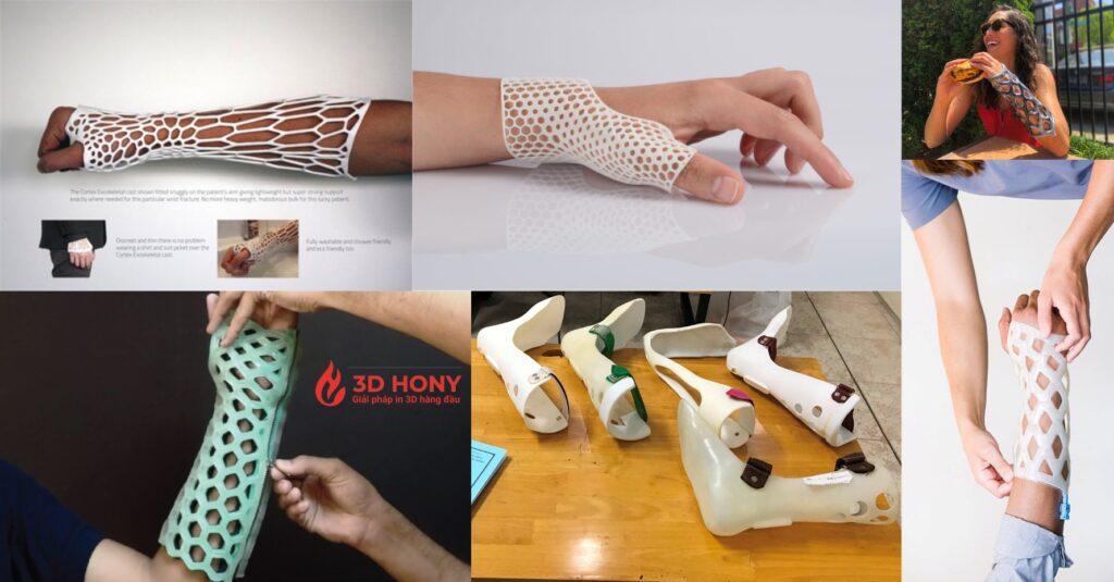 Công nghệ in 3D ngày được quan tâm và ứng dụng rộng rãi trong nhiều ngành nghề khác nhau
- Ứng dụng in 3D trong y tế
- Ứng dụng in 3D trong ngành điêu khắc
- Ứng dụng công nghệ 3D trong công nghiệp
- Ứng dụng in 3D trong ngành nội thất
- Ứng dụng công nghệ in 3D trong ngành sx ô tô
- Ứng dụng in 3D trong ngành xây dựng