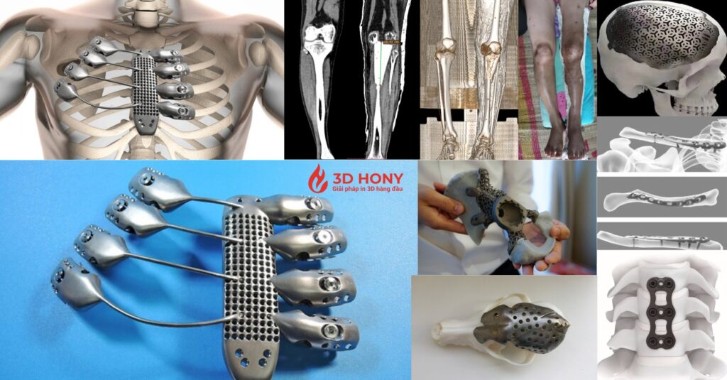 Công nghệ in 3D ngày được quan tâm và ứng dụng rộng rãi trong nhiều ngành nghề khác nhau
- Ứng dụng in 3D trong y tế
- Ứng dụng in 3D trong ngành điêu khắc
- Ứng dụng công nghệ 3D trong công nghiệp
- Ứng dụng in 3D trong ngành nội thất
- Ứng dụng công nghệ in 3D trong ngành sx ô tô
- Ứng dụng in 3D trong ngành xây dựng